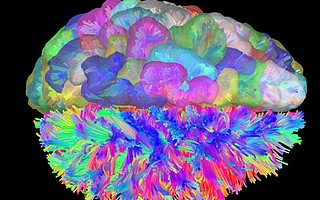 This brain image represents a dataset from the study and the regions used as nodes.