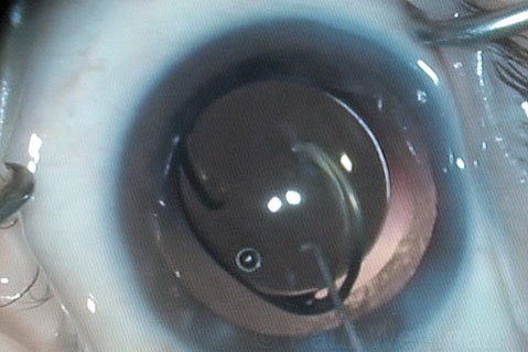 photo thumbnail