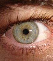 photo thumbnail