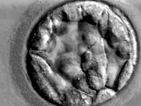 Photo detail