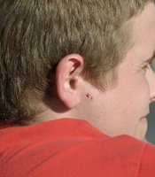 photo thumbnail