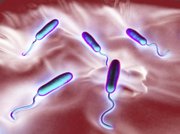 These Vibrio cholerae are bacteria that cause cholera, an infection of the small intestine transmitted to humans via contaminated food or waste.