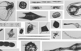 Images of cells like these seen on the Imaging Flow Cytobot could tell scientists who's eating whom, their health, and the amount of ash in the water.